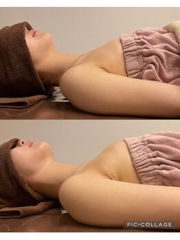 アネラ 京都駅前店(Anela)/【横のBefore & After】