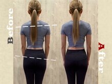リズボディ(RizBody)/【Before After】施術1回目