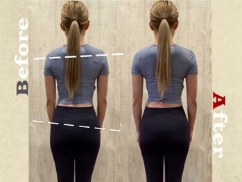 リズボディ(RizBody)/【Before After】施術1回目