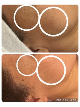 ルピナージュ(Lupinage)/【再生美容】最強エイジング☆