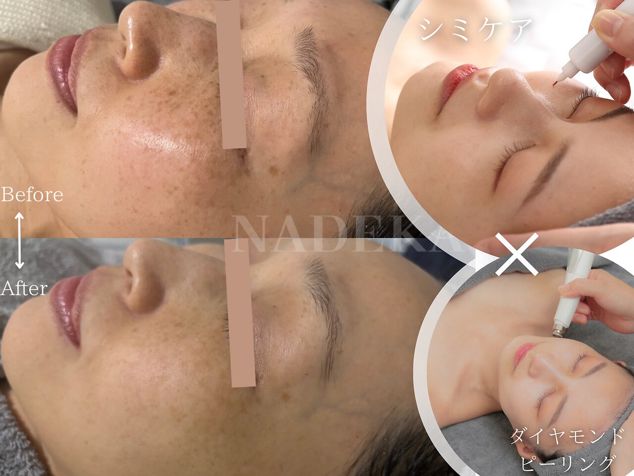 京都市下京区でEMSが人気のエステサロン｜ホットペッパービューティー