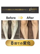 グロワール(gloire)/メンズ足脱毛