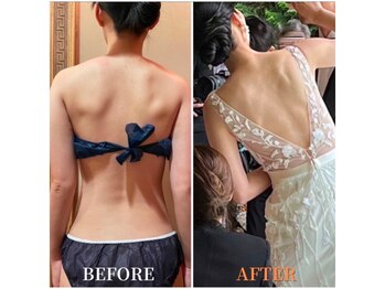 ビューティースタイリング 自由が丘店(beauty styling)の写真/SNSでも話題のビュースタのブライダル痩身☆〈人気No.1背中～二の腕徹底痩身〉で最高な花嫁姿に！