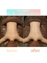 ビタミンスパ 中野店/施術回数★1回目