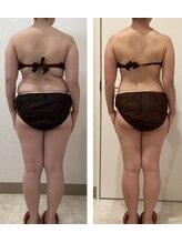 ボーテ(beaute)/【ビフォーアフター】