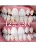 【誰でも簡単白い歯に☆】 12分×3回 セルフホワイトニング 5800円