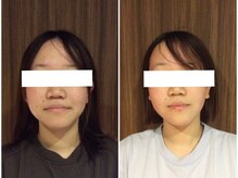 美容整体ウェリナ 名駅院/小顔矯正/骨盤矯正/美脚サロン