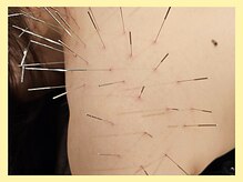 はりきゅう和 ルート鍼灸院