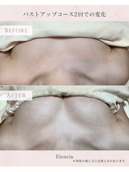 エレンシア(E'lencia)/施術効果（Before/After）