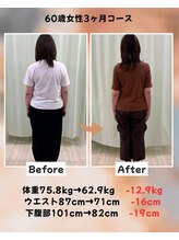 くさば整骨院/60歳女性/ダイエット3か月コース