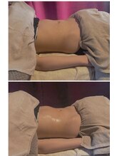 ヴァローレ(valore)/お腹の張り撃退