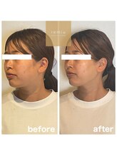 レミュー(remiu)/テラボーラー★小顔パーソナル