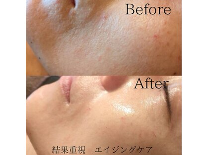 ルアーナ(Luana)の写真