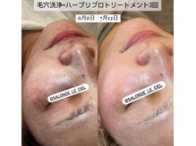 サロンドゥルシェル(salonde_le ciel)の雰囲気（本気で肌質改善を目指す方は、お肌の土台を整えるハーブリプロ◎）