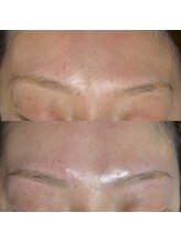 ブリリア(Brillia)/左右差のある眉も一本ずつ微調整