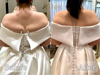 エール 恵比寿店(AILES)/ブライダルエステ