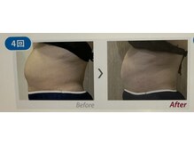 ケーナイン(K nine)/アイスナイフで気になる部位撃退