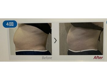 ケーナイン(K nine)/アイスナイフで気になる部位撃退