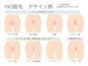 日本製最新脱毛マシン☆光VIO脱毛　5000円
