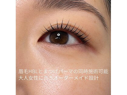 アンカー(ANCHOR)の写真