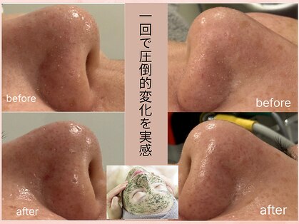 ラボーテアッシュ(La beaute H)の写真