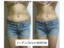 ランネル(Runnel)/インディバビフォーアフター