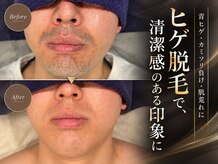 ボゴス(BOGOSS)