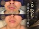 ボゴス(BOGOSS)の写真