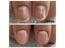 プライベートサロンエム(M)/自爪育成コース