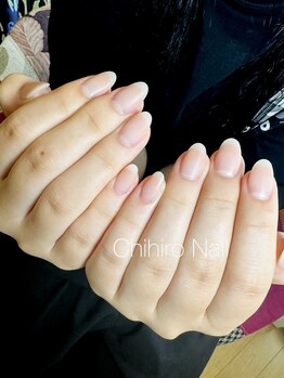 チヒロネイル/縦長ネイルベットスカルプ