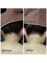 サロン ピューパ(Salon pupa)/うなじ　before→ after