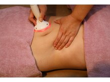 ルナ(Luna)/人気の温熱吸引