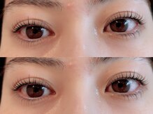 ユーロ(EURO)/上下ラッシュリフト