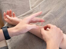 クーロ鍼灸院(curo鍼灸院)/肘・肩関節