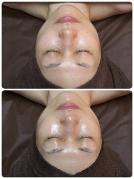 ウララ(ulala)/ララピール1回目