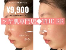 ザ アールアール(THE RR)