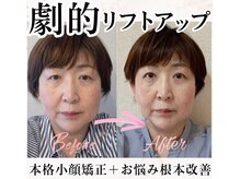 アシュネ(Axiune)