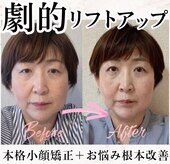 アシュネ(Axiune)