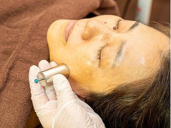 ままの森鍼灸マッサージ院の写真/美容特許を取得したダーマ美容鍼でシミしわ・にきび・たるみ・毛穴改善♪新しい美容鍼をぜひご体感下さい!