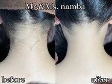 うなじを整えるとこんなに変わります♪