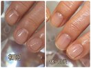 ネイルケア施術経過