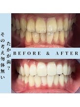 ドルチェ 水戸店(Dolce)/★ before → after ★