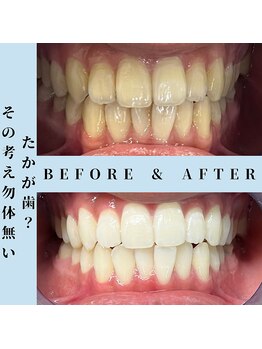 ドルチェ 水戸店(Dolce)/★ before → after ★