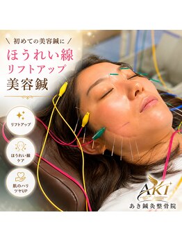 あき鍼灸整骨院の写真/【国家資格者による美容鍼】筋膜&骨格へアプローチ！たるみやほうれい線に◎血流改善で若々しい印象へ♪