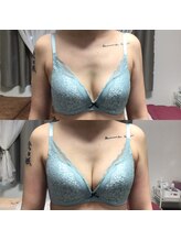 マイントゥー(mine too)/授乳後バストもハリアップ