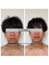 ルシアル(LUCIALL)/
