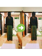 サプライズ整体院/30代ママさんの産後の骨盤初回