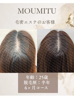 ボディデザインホームクレアフェリーチェ 神戸(Body design home Crea felice)/MOUMITUスカルプ/毛密エステ