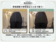 骨格調整所 骨丸の雰囲気（側弯の方の前屈比較。優しくじんわりと骨格を整えていきます。）