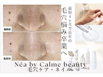 カルム(Calme)の写真